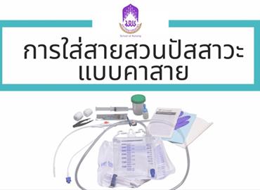 การใส่สายสวนปัสสาวะแบบคาสาย